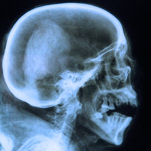 Telerradiografía de Cráneo en Barcelona  Cetir  al precio de 19€